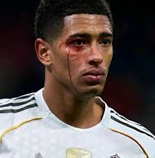 Rayo Vallacano vs Real Madrid match result