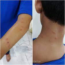 Bagaimana cara menghilangkan kutu kucing atau cara membersihkan kutu pada kucing? Bila Diserang Kutu Kucing Di Rumah Seksa Oiiii Mama Kembar Tiga