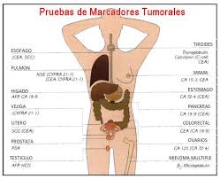 Que Son Los Marcadores Tumorales Cuantos Tipos Hay Auxiliar De Enfermeria Enfermeras De Urgencias Educacion Para La Salud