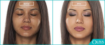 The dose of this medicine will be different for different patients. Salicylic Acid Peels Benefits Cost Before After Results