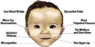 Radiological Studies Of Fetal Alcohol Spectrum Disorders In Humans And Animal Models An Updated Comprehensive Review Sciencedirect
