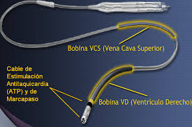 Analizar y registrar la actividad eléctrica propia del corazón. El Funcionamiento Del Desfibrilador Automatico Implantable Someec