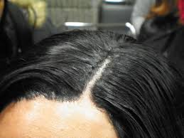 This styling technique is done by molding the getting your hair done by a hairstylist may not be in your budget, so you may want to try this on your own. Phenomenalhaircare Infusion Hairline Beyond The Invisible Part