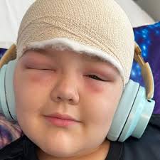 Fundraiser by Todd King : Recovery costs for Jye after brain surgery