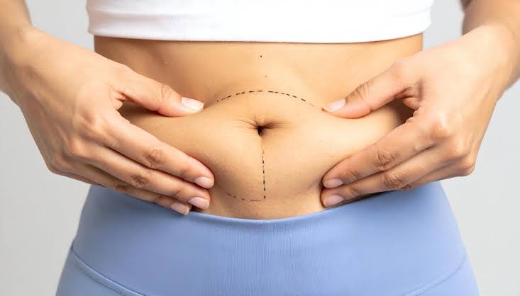 5 Reasons to Get a Tummy Tuck in Dubai | Dr. Matteo Vigo