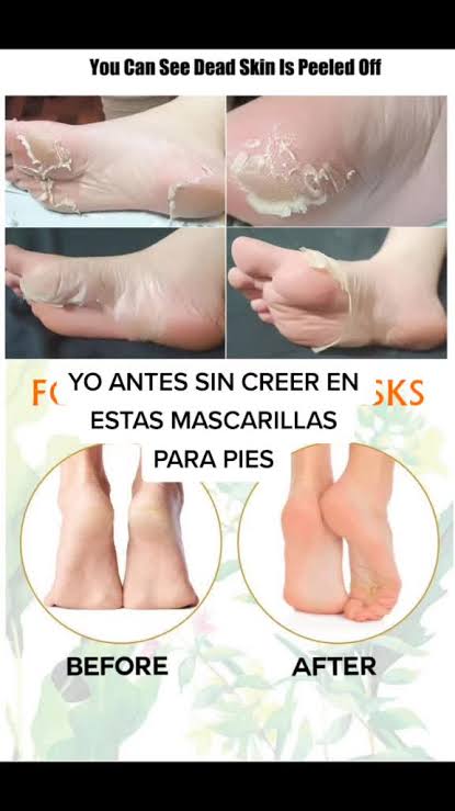 Mascarilla Peeling para Pies: ¡Mimate y Descubre Resultados Increíbles!