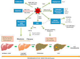 Суммарные антитела к вирусу вирус гепатита с, определение рнк кол. Molecular Mechanisms Of Hepatitis C Virus Induced Hepatocellular Carcinoma Clinical Microbiology And Infection