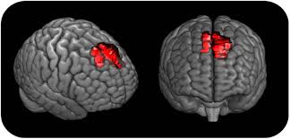 Are you ready to spend all your money on d. The Charm Of Structural Neuroimaging In Insanity Evaluations Guidelines To Avoid Misinterpretation Of The Findings Translational Psychiatry