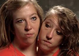 Born in minnesota to patty, a registered nurse, and mike hensel, who is a carpenter and also landscaper, the twins were raised there in new germany. 30 Interesting Things About Famous Conjoined Twins Abby And Brittany Hensel