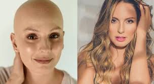La linda colombiana claudia bahamón nacio en la ciudad de neiva, en el huila, el 5 enero 1979. Irreconocible Claudia Bahamon Se Rapo La Cabeza Para Apoyar A Una Amiga Con Cancer