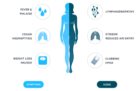 Lung cancer is the deadliest type of cancer, causing more than 150,000 deaths annually in the united states. Pulsenotes Lung Cancer Notes