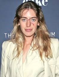 Anouk mcgregor (adopted daughter with eve mavrakis). Clara Mcgregor S Face Will Get Bitten By A Canine However She Nonetheless Walks The Purple Carpet Hollywood Life India Live News