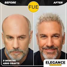 Elegance Hair Clinic