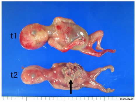 Mga resulta ng larawan para sa Partial Molar Twins"