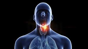 Knowing what mouth cancer look like can help you in diagnosing it at an earlier stage. Persistent Sore Throat Can Be Cancer Sign Bbc News