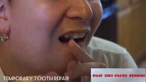 (isi 50 butir) temptooth /gel penambal gigi original. Temptooth Lem Gel Padat Untuk Buat Gigi Palsu Sendiri Temporary Tooth Repair Youtube