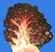 Image result for Sarcophyte