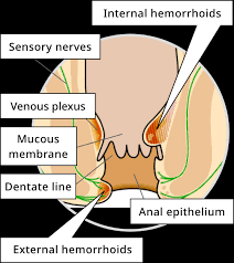 Bleeding from a burst hemorrhoid can last anywhere from a few seconds to several minutes. Characteristics Of Hemorrhoids Piles Official Brand Site