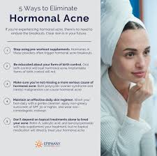 Birth control can be an agent for breakouts or can be used to solve them; How To Get Rid Of Hormonal Acne Diagnosis Treatment Options