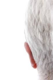 Common signs and symptoms of a lice infestation can include: Pin On Health Diet N Remedies
