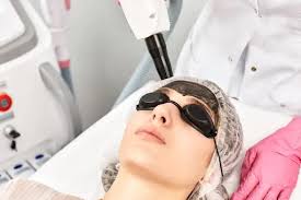 8 Pantangan Setelah Laser Black Doll