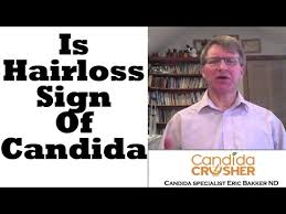 Hair loss — candida overgrowth can also cause hair loss. Can Candida Cause Hair Loss Constipation Candida Diet Cleanse Recipes By Eric Bakker N D