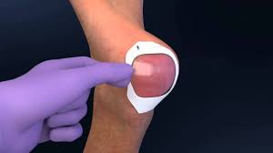 Product used in this demonstration is th. Tegaderm Transparent Film Dressing 1624w Application Animated Youtube