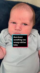 New-born's 'grumpy face' was a sign something was wrong. . . . #AlderHey  #baby #Love #UKNews #Miracle #LocalNews