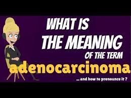 When a doctor diagnoses an illness in a patient, they are giving their professional medical analysis of what the source of the symptoms is. What Is Adenocarcinoma Adenocarcinoma Signs Symptoms Causes Treatment Youtube