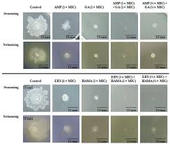 Cefepime* 2 g iv q8h + metronidazole 500 mg po/iv q8h + fluconazole* 800 mg x1, then 400 mg q24h Pathogens Free Full Text Synergism Of The Combination Of Traditional Antibiotics And Novel Phenolic Compounds Against Escherichia Coli Html