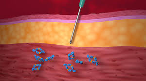 Image result for Humularia