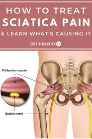 Pin On Sciatica Pain Relief Exercises