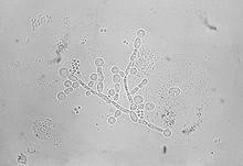 Candida Albicans Wikipedia