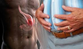 That's because skin cancer usually begins where you can see it. Stomach Cancer Symptoms Pain Weight Loss Bleeding Sickness Indigestion And Dark Poo Express Co Uk