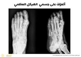 جسم الانسان الهيكل العظمي صور اشعة يد رجل فوتوغرافية Holding Hands Hands