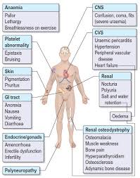 This happens when a piece of plaque from a larger artery breaks off. Symptoms And Signs Of Chronic Kidney Disease Signs Grepmed