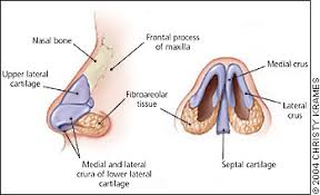 Fracture of nasal bone â€ closed reduction. Management Of Acute Nasal Fractures American Family Physician