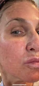 Med spa services near me in ashland, or. Illume Aesthetics 993 Siskiyou Blvd Ste 1 Ashland Or Medical Spas Mapquest