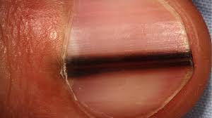 Pin On Health Related