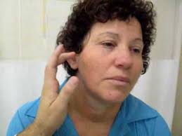 Maybe you would like to learn more about one of these? Chevostek Youtube