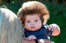 When combed forward, the new hair blends with the old hair nicely. Meet 2 Month Old Baby With The Craziest Bouffant Hair Ever Bored Panda