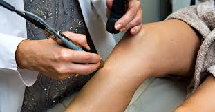 Hair #Maleunwantedhairremoval #Remove #Trick #Unwanted #Hair  #Maleunwantedhairremoval #Remove … | Unwanted Hair Removal, Unwanted Hair,  Remove Unwanted Facial Hair