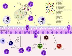 The most serious and common complications of cystic fibrosis are problems with the lungs, also. Host Pathogen Interplay In The Respiratory Environment Of Cystic Fibrosis Journal Of Cystic Fibrosis