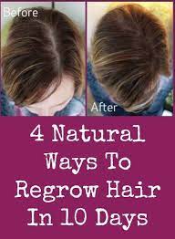 While hair loss is very common, losing your hair can still be a frustrating experience. 4 Natural Ways To Regrow Hair In 10 Days Regrow Hair Hair Vitamins Hair Growth Tips