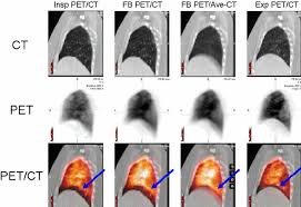 Prepare to spend 2 hours with us. Perfusion Pet Ct Showing Effects Of Respiratory Motion On Image Download Scientific Diagram