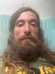 Fundraiser by Evan Morganstern : Help Seay Recover from Severe Brown  Recluse Spider Bite