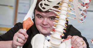 How Abergele schoolboy's lunch-time experiments taught him the best way to  break bones