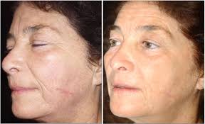 Diane — VILLANI MEDICAL