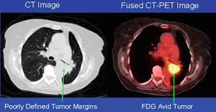 The Ionizing Radiation Interaction With Matter The X Ray Computed Tomography Imaging The Nuclear Medicine Spect Pet And Pet Ct Tomography Imaging Intechopen