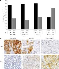 V Domain Ig Containing Suppressor Of T Cell Activation Vista A Potentially Targetable Immune Checkpoint Molecule Is Highly Expressed In Epithelioid Malignant Pleural Mesothelioma Modern Pathology